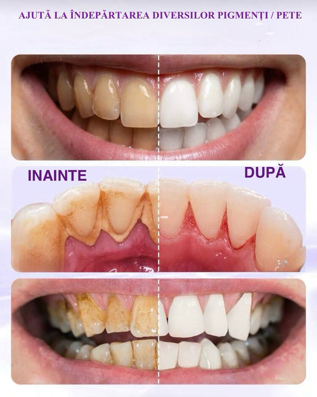Pudra Pentru Albirea Dintilor